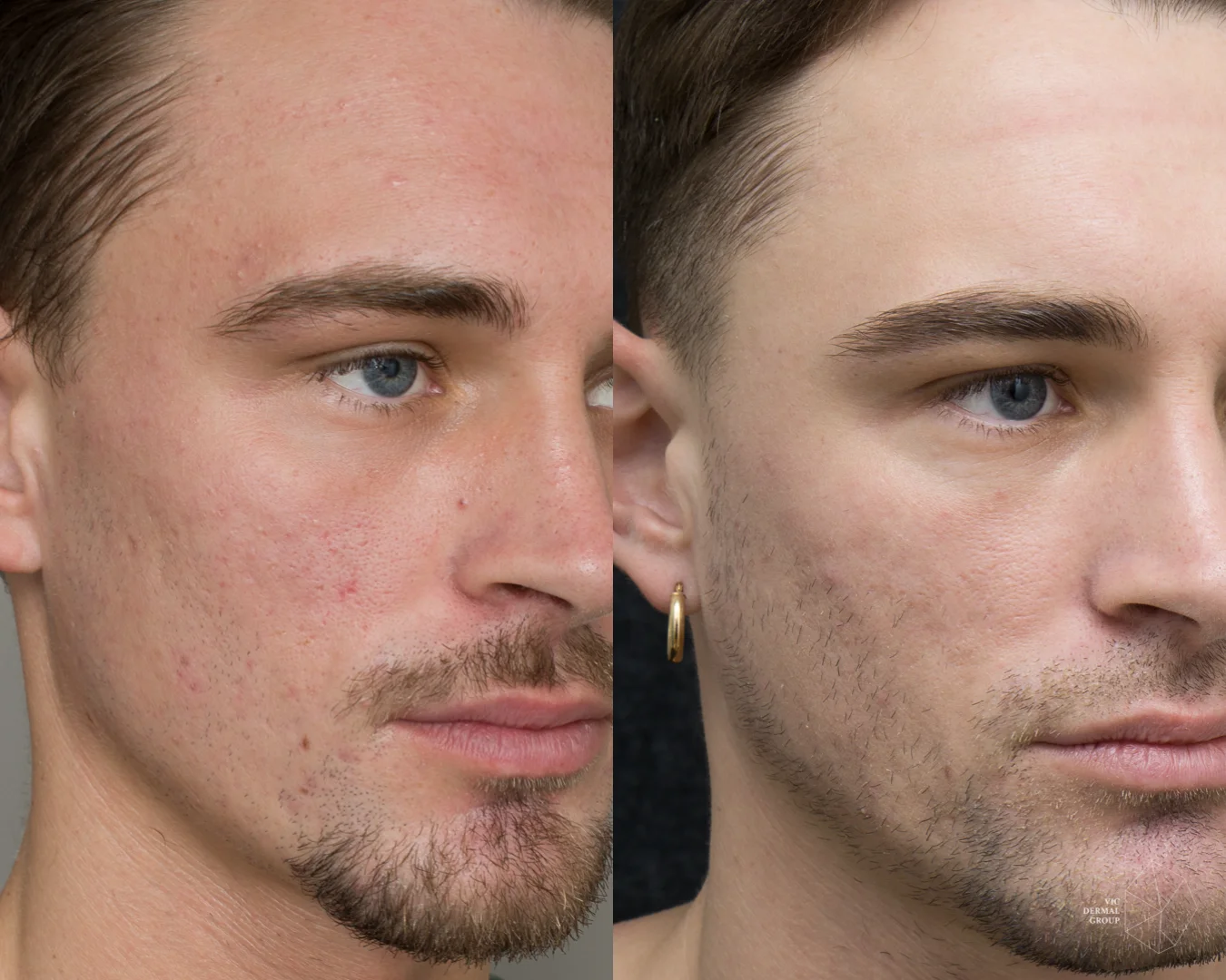 6784afa78503ab39b118ec5e 6784addd83087bab18f3653b at20tca20scar